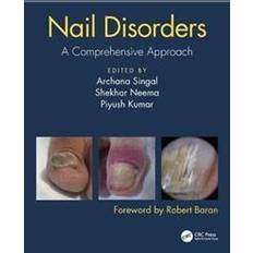 Nail Disorders (Inbunden, 2019)